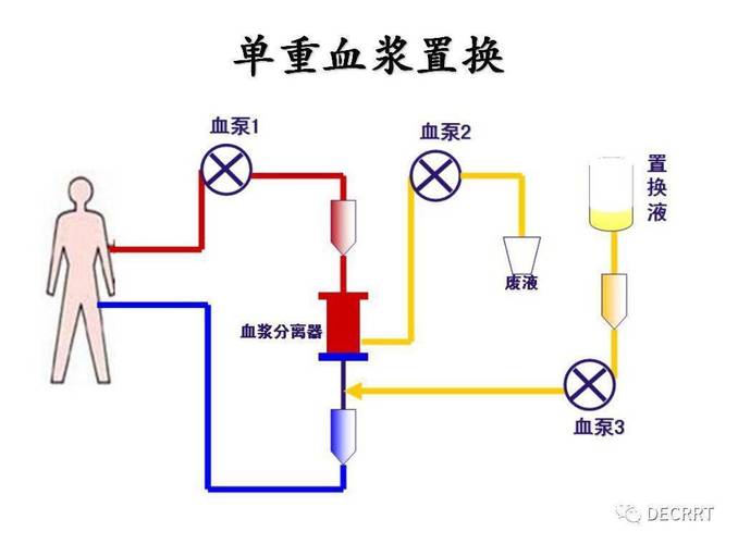 血浆爆裂怎么办?别慌,这里有解决方法!