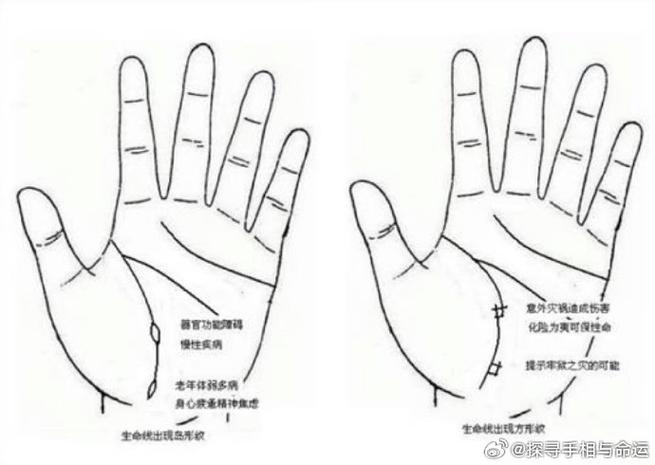 生命线攻略难点在哪?高玩教你轻松过关!